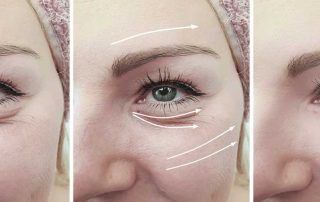 Simple therapies that renew skin