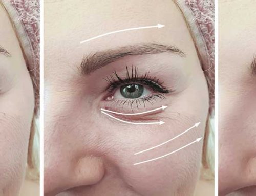 The AURELLA Skin Perfect – Simple therapies that renew skin