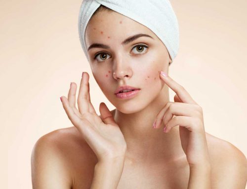 Blemish-free and clear skin